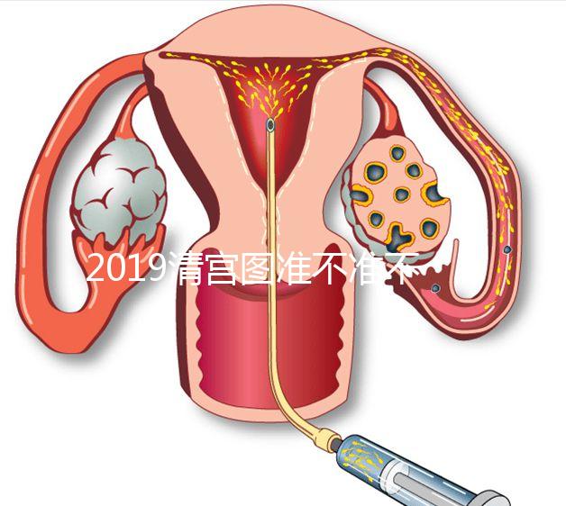 2019清宮圖準不準不知道，但檢測生男女這3種方法才科學