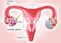 2024年,武漢同濟(jì)醫(yī)院不孕癥醫(yī)生排名公布,選擇專家迅速登記
