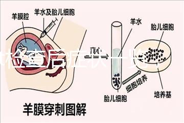 tct檢查后癥狀一覽，專家提醒做好處理措施是關鍵